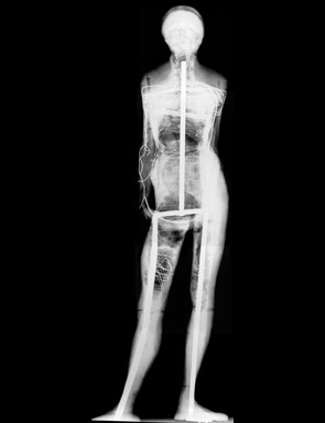Radiograph of the wax