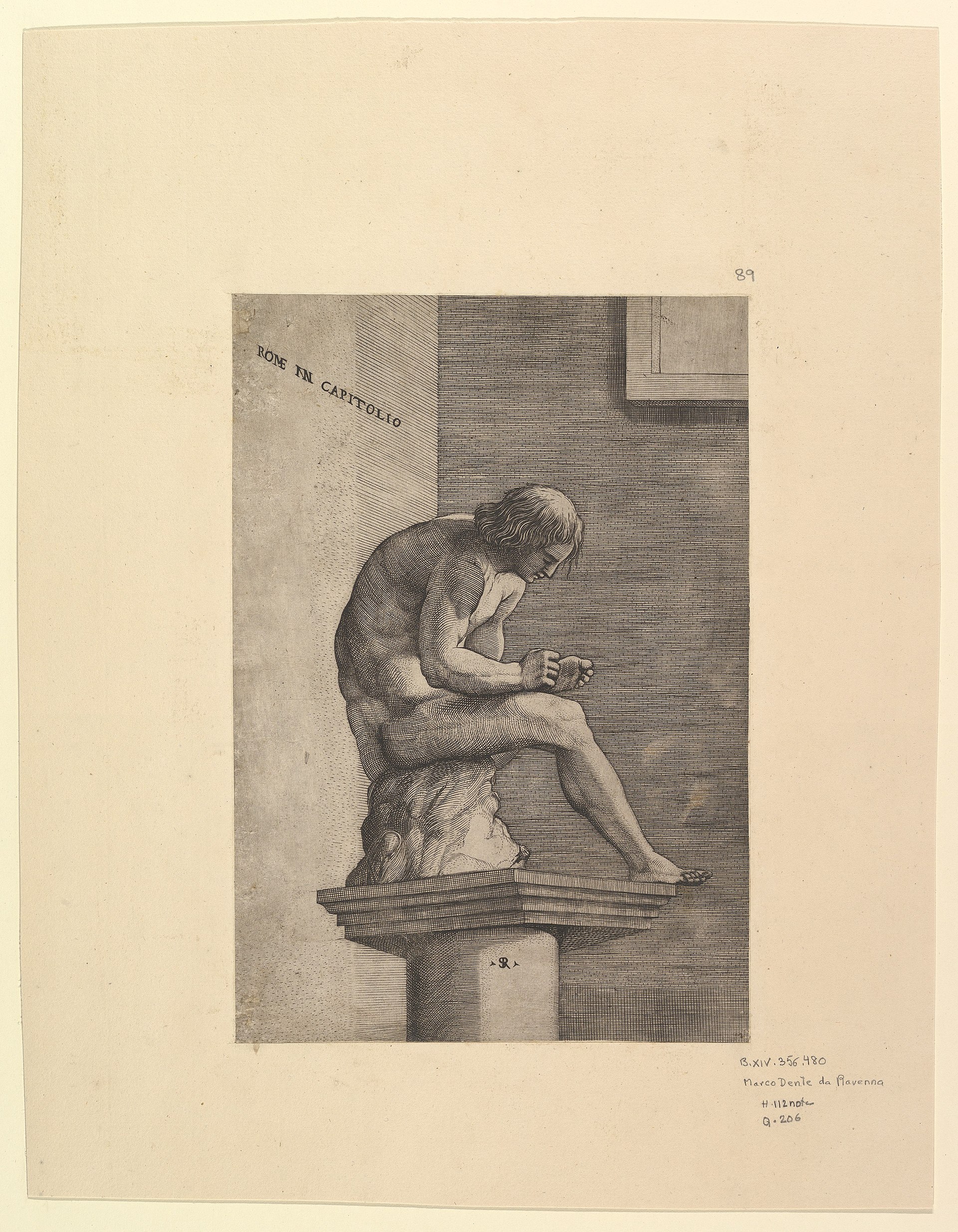 Man Removing a Thorn from his Foot